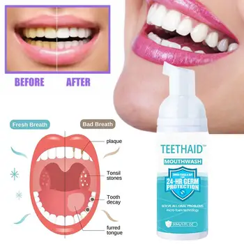 Жидкость для полоскания рта Teethaid, мятная пена для отбеливания зубов, мусс для удаления пятен 0